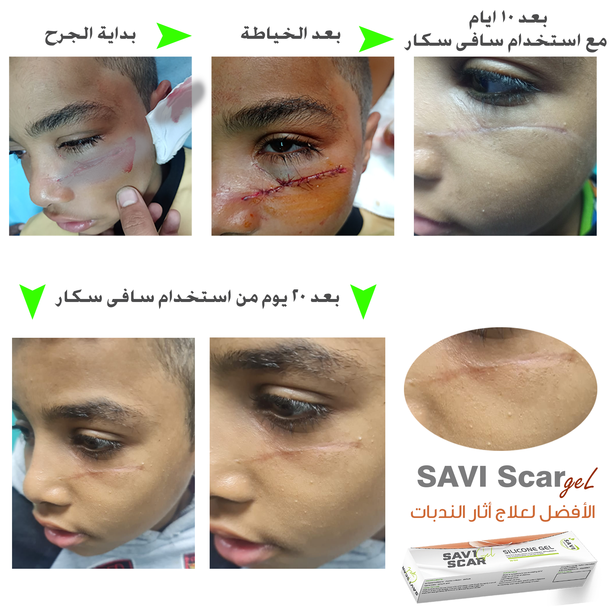 صورة 2